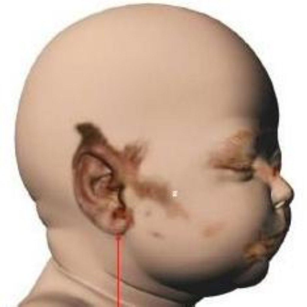 An illustration of Baby P